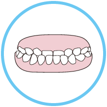 牙齿发育期常见问题